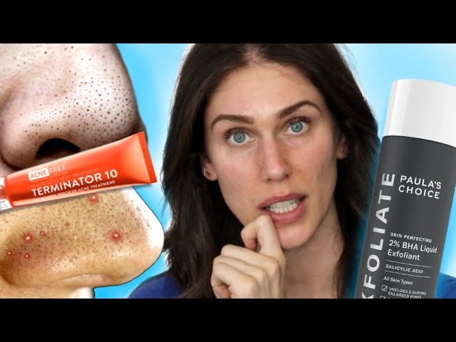5 Types of Acne and Best Ingredients To Treat Them
