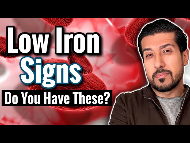 7 SIGNS of Iron Deficiency to Catch Now | Iron Deficiency Without Anemia