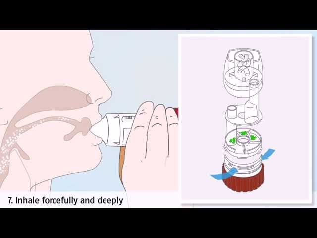 Asthma treatment: how to use a Turbuhaler