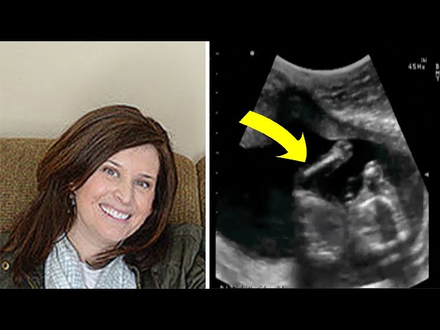 Mom’s Ultrasound Photo Reveals A ‘One In A Million’ Pregnancy Coincidence