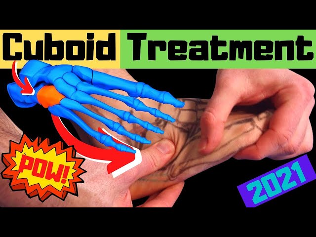 Cuboid Syndrome Self Treatment [Cuboid Bone: Outside of Foot Pain]