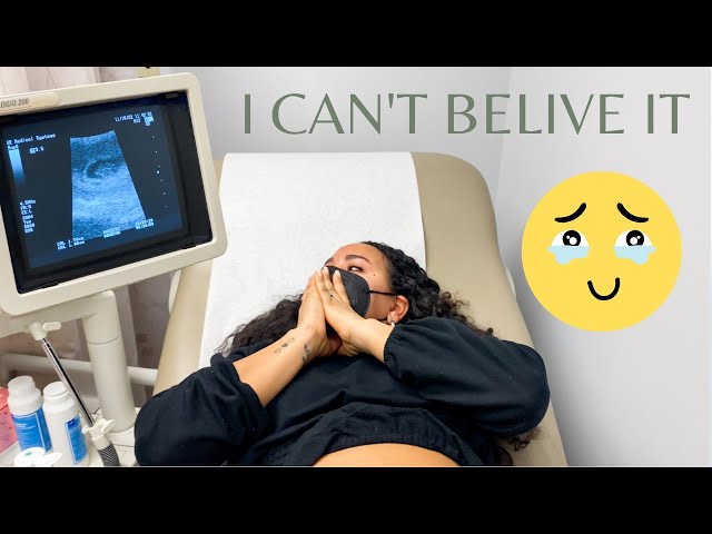 Seeing Our Baby For the First Time Ultrasound | Rainbow Baby | 8 weeks Pregnant