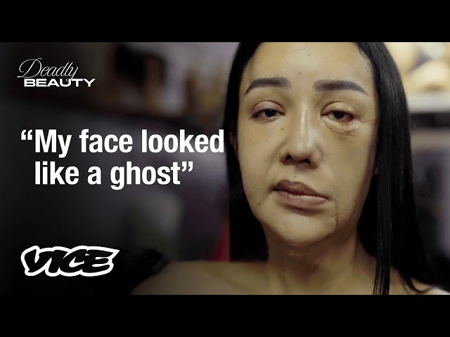 Botched Facial Injections in Thailand | Deadly Beauty