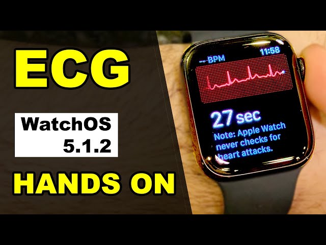 Apple Watch ECG (Hands On) - How to take an ECG on Apple Watch 4
