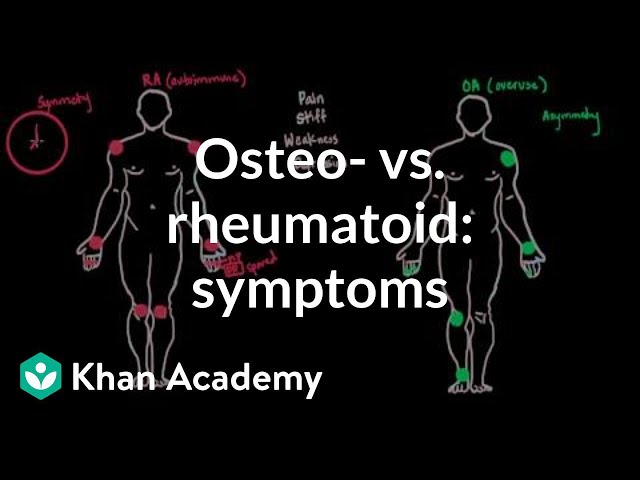 Osteoarthritis vs rheumatoid arthritis symptoms | NCLEX-RN | Khan Academy