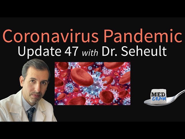 Coronavirus Pandemic Update 47: Searching for Immunity Boosters & Possible Lessons From Spanish Flu