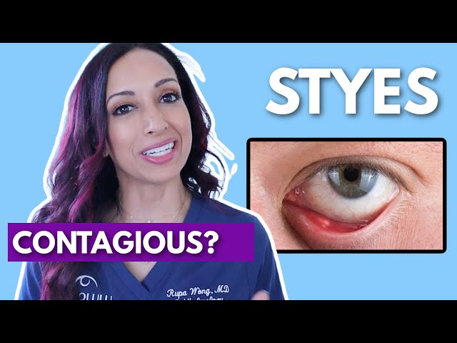 Are Styes Contagious? Eye Doctor Debunks