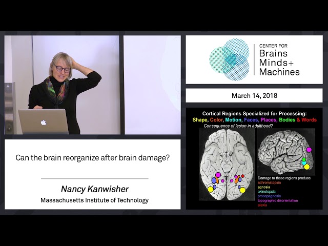 8.11 - Can the brain reorganize after brain damage?