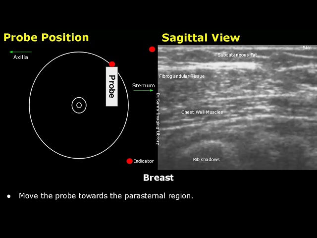 Breast Ultrasound Probe Positioning | Sagittal, Radial Views & Clock System USG Transducer Placement