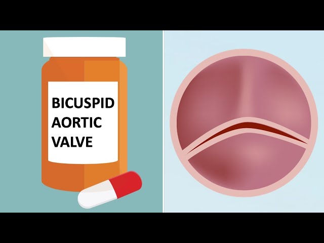 Bicuspid Aortic Valves & Medication: Top 7 Facts with Dr. Luis Castro