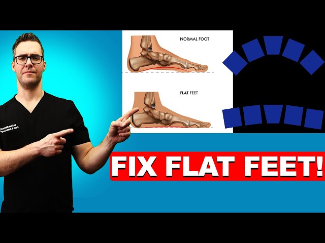 How To FIX Flat Feet: 16 BEST Home Remedies [Shoes & Arch Insoles]