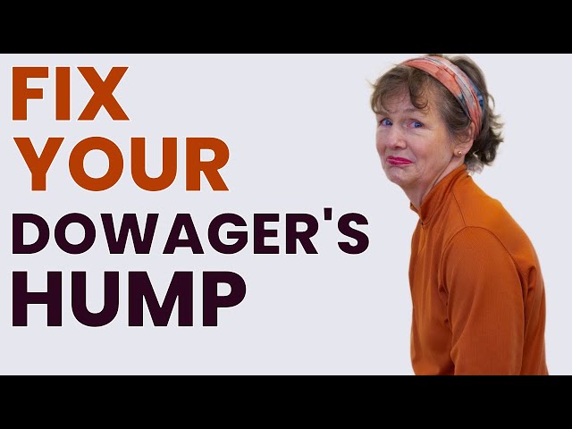 Get Rid of Dowager's Hump