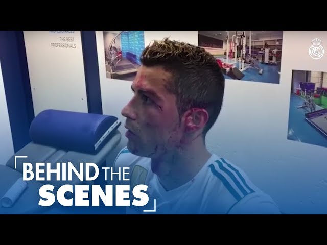 Cristiano Ronaldo INJURY | BLOOD ALL OVER FACE