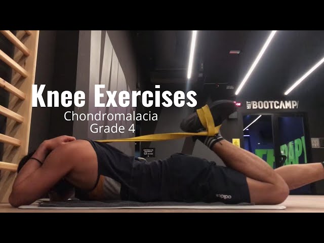 Knee Exercises | Chondromalacia Patella Grade 4