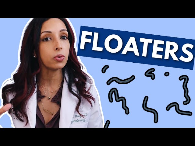 What Causes Eye Floaters? Eye Doctor Explains
