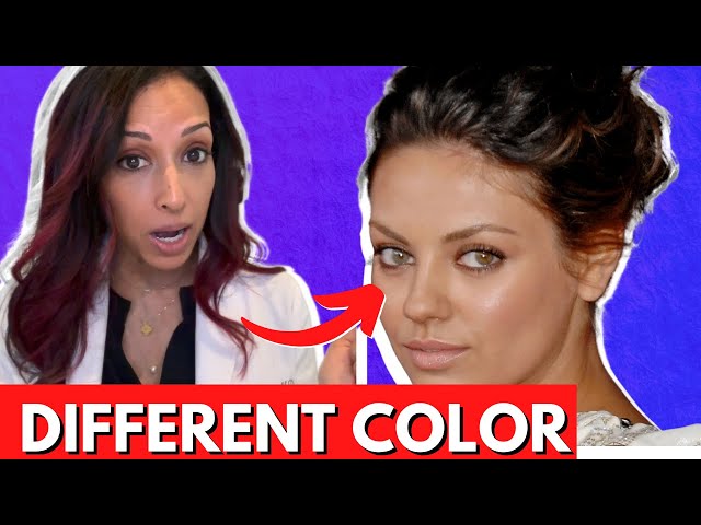 Why Are Mila Kunis' Eyes Different Colors? Eye Doctor Explains