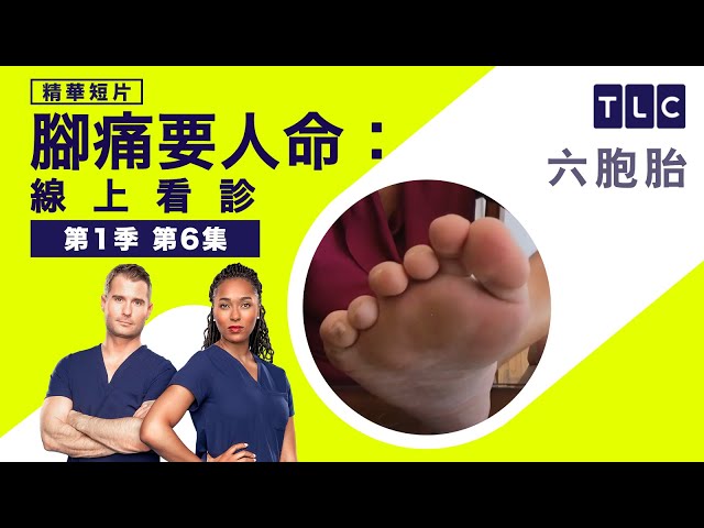 《腳痛要人命：線上看診》六根腳指頭，又只能穿女鞋？｜TLC 旅遊生活頻道