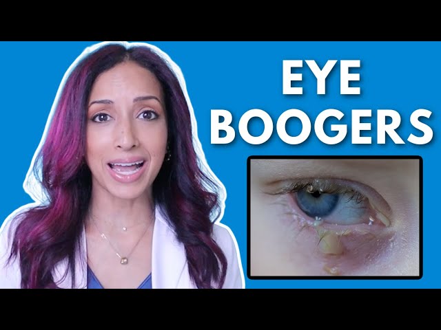 Is Morning Eye Discharge Normal? Eye Doctor Explains