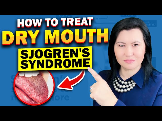 Sjogren's Syndrome: Dry Mouth Treatment Options