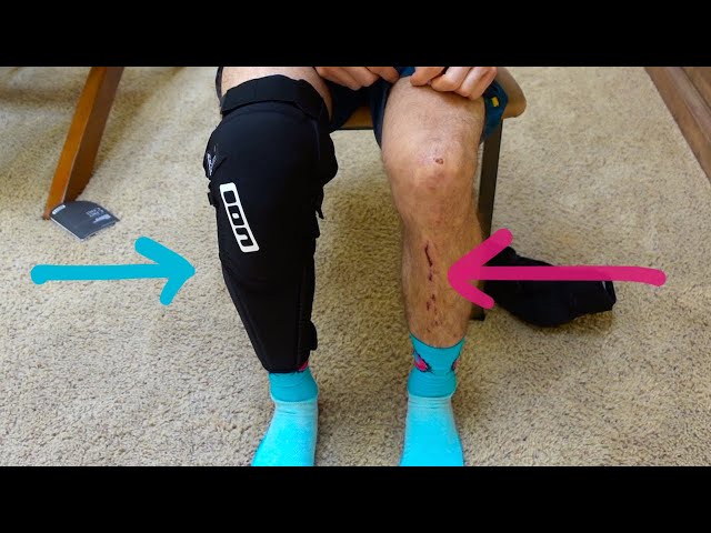 MTB KNEE PAD SHIN GUARD UNBOXING & REVIEW | ION K-PACT SELECT | Ep. 39