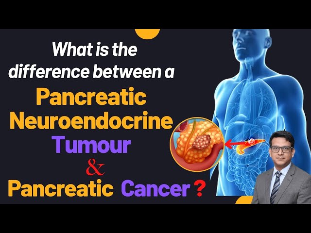 Difference between Pancreatic Neuroendocrine tumor and Pancreatic Cancer | #cancer #treatment