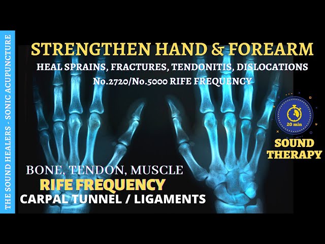 Hand And Forearm Healing RIFE Frequency ➤ Wrist Sprains ➤ Bone Fracture ➤ Damaged Ligament & Tendons