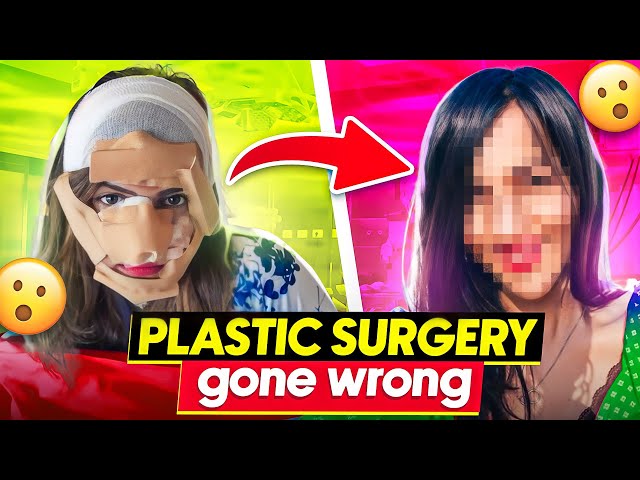 I got Plastic Surgery and Now I REGRET it 😱 (YE KYA KAR LIYA) ?