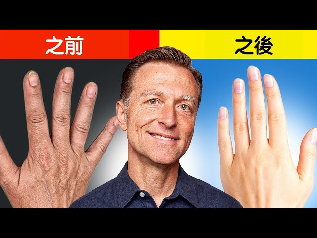 手乾,手皺,第一名天然護膚法,柏格醫生 Dr Berg （220217)