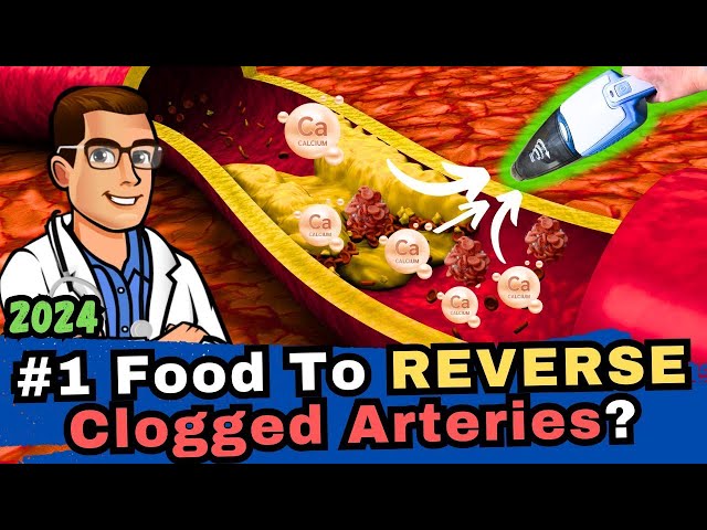 #1 Food to Clean out Your Arteries? [Blood Clots & Arteriosclerosis]