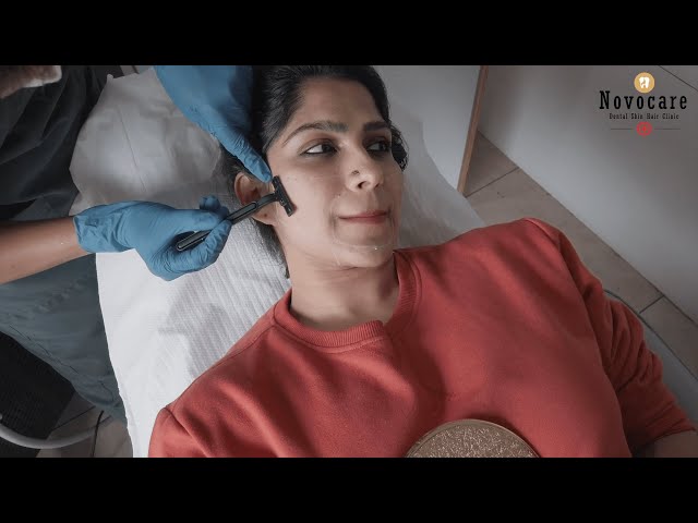 മുഖ സൗന്ദര്യത്തിനു ലേസർ ചികിത്സ| Face Laser Treatment | Novocare
