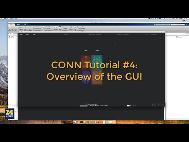 CONN Tutorial #4: Overview of the GUI