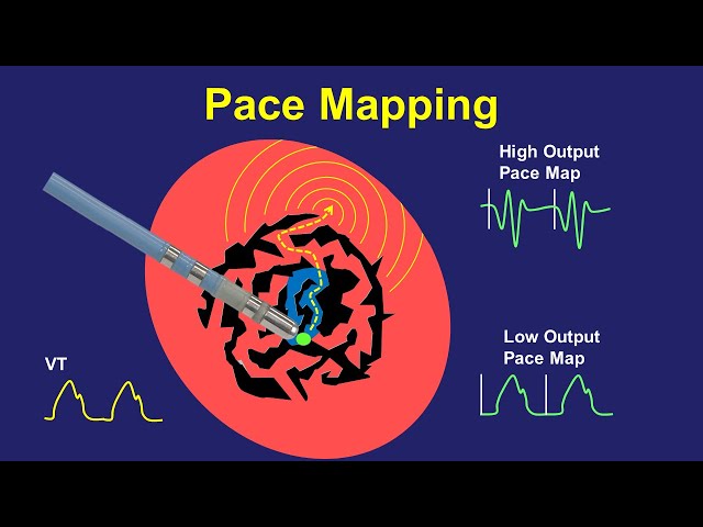 Pace Mapping:  Principles and Pitfalls