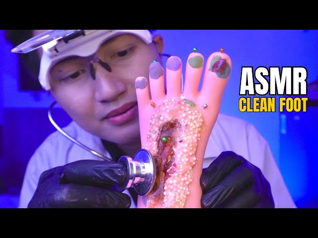 ASMR Doctor | Clean Your Foot From WOUNDOS