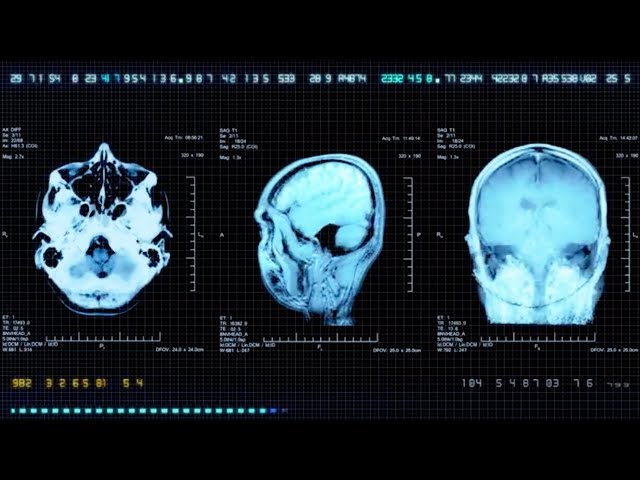 A Look at the Future of Concussion: Episode 1