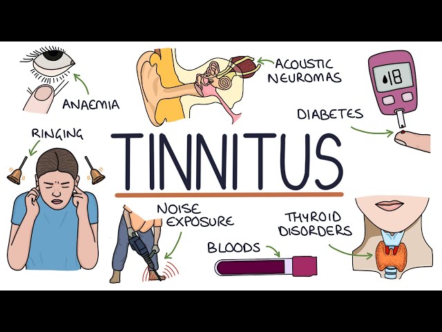 Understanding the Causes of Tinnitus