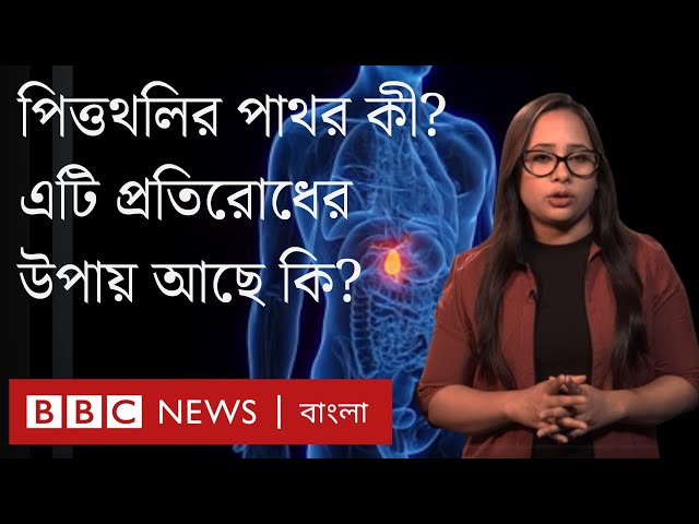 পিত্তথলির পাথর কী? হলে কী করবেন? প্রতিরোধের উপায় কী? | BBC Bangla