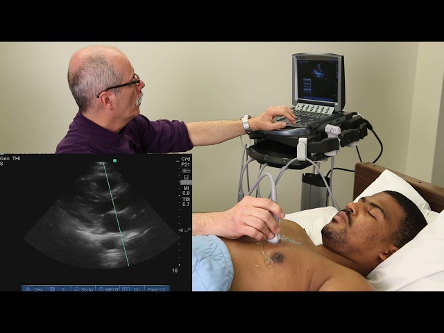 Advanced Critical Care Echocardiography - Complete Exam