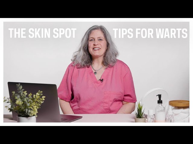 Your Wart Questions, Answered | The Skin Spot Ep. 3
