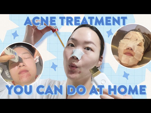 Derm's Acne Treatment Routine that you can do AT HOME! #homecare