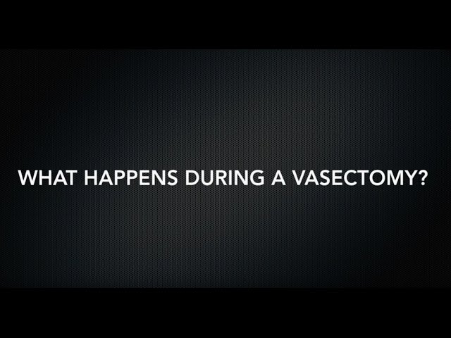 Dr. Aaron Spitz - What Happens During a Vasectomy?