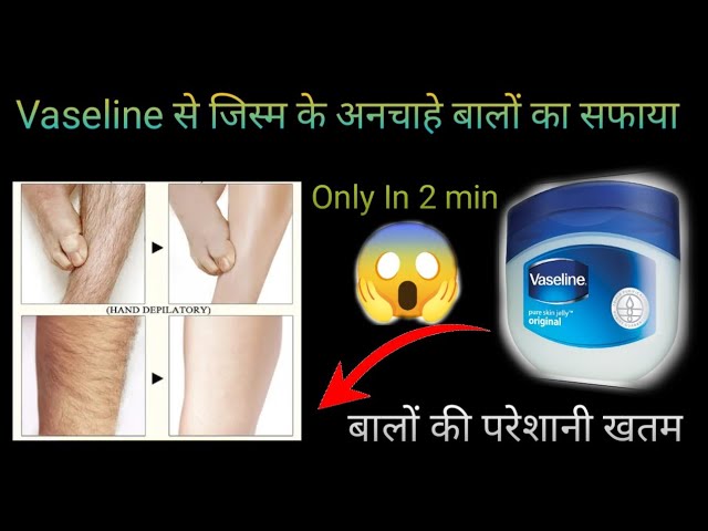 In 5 minutes 😱 Remove Unwanted Hair Permanently , No Shave No Wax , Painlessly Remove Unwanted Hair🔥