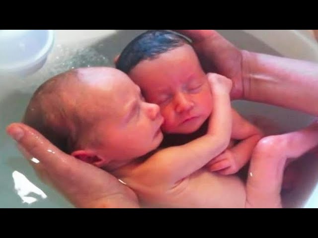 Nurse Screams Upon Childbirth, Mother Takes A Look At Her Twins And Realizes What Happened