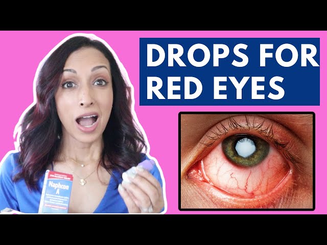 Drops For Red Eyes | Eye Doctor Compares