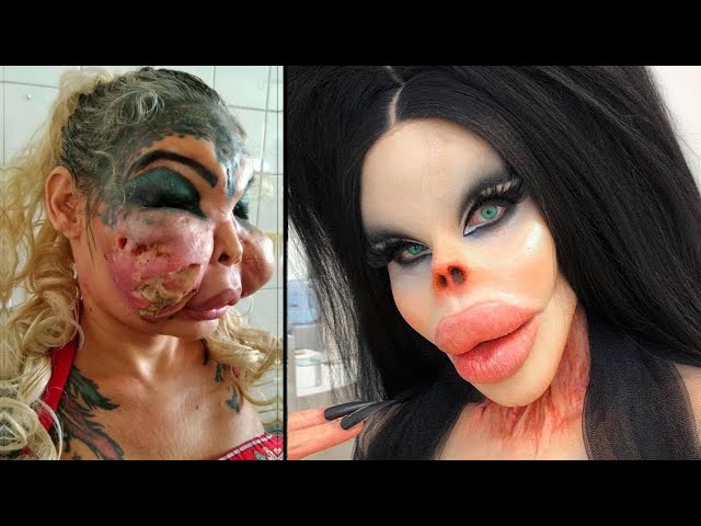 When Plastic Surgery Goes Horribly Wrong