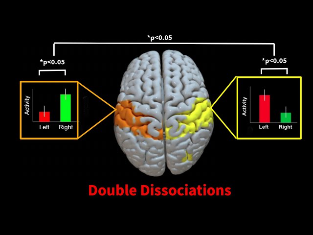 Double Dissociations in fMRI