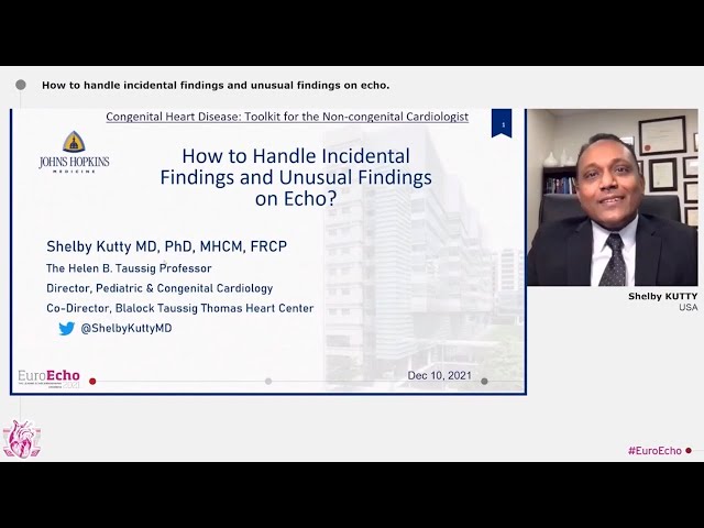 EACVI EuroEcho 2021: Incidental and Unusual Findings on Echocardiography: Shelby Kutty, MD, PhD.