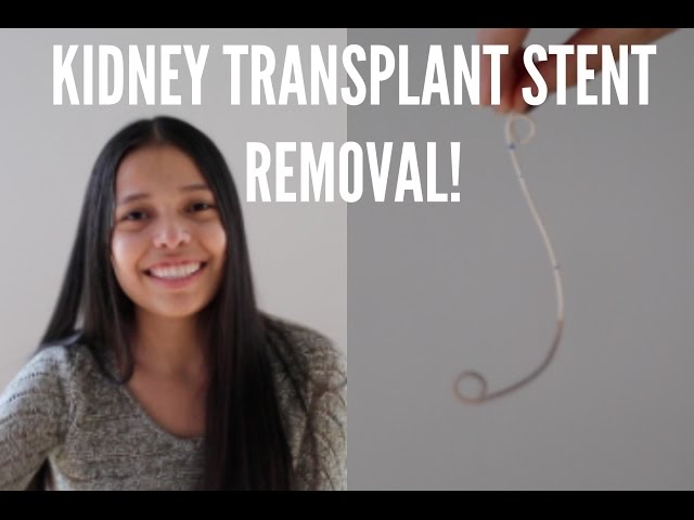 Kidney stent removal