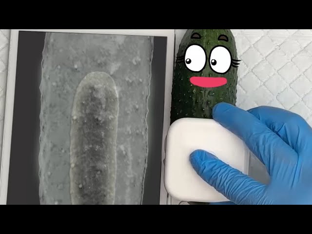 WOW! Doodles And Their Secret Fears! Cucumber needs surgery Baby Birth, Funny Video, fruitsurgery