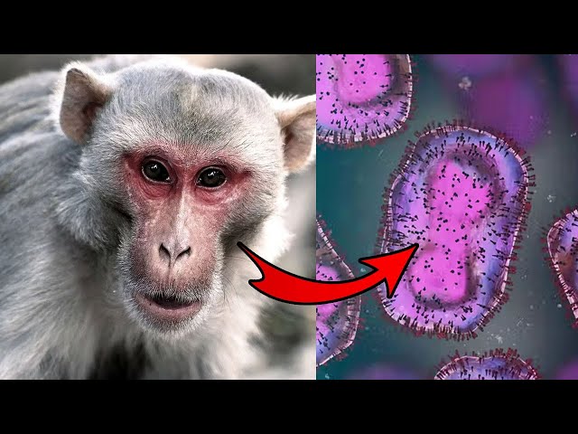 What If The Monkeypox Virus Can't Be Contained?