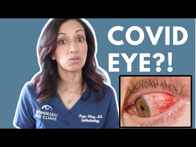 How Does COVID-19 Affect Your Eyes? Eye Doctor Explains